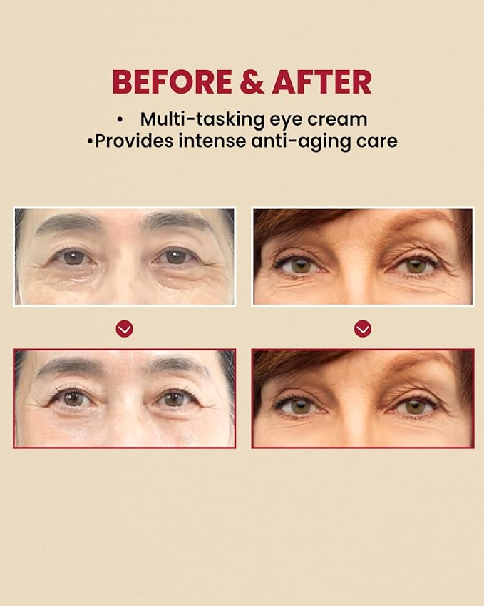 K-SECRET SEOUL 1988 Eye Cream : Retinal Liposome 4% + Fermented Bean.