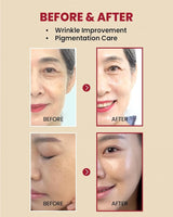 K-SECRET SEOUL 1988 Serum : Retinal Liposome 2% + Black Ginseng, 30ml.