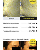 Celimax - The Vita-A Retinol Shot Tightening Serum - FineLook