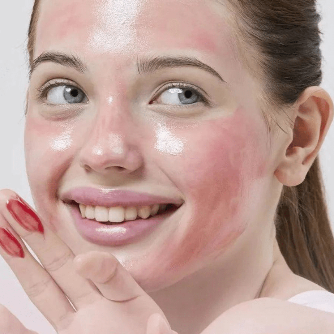 The AHA BHA PHA LHA 35 Peel - 30 mL.