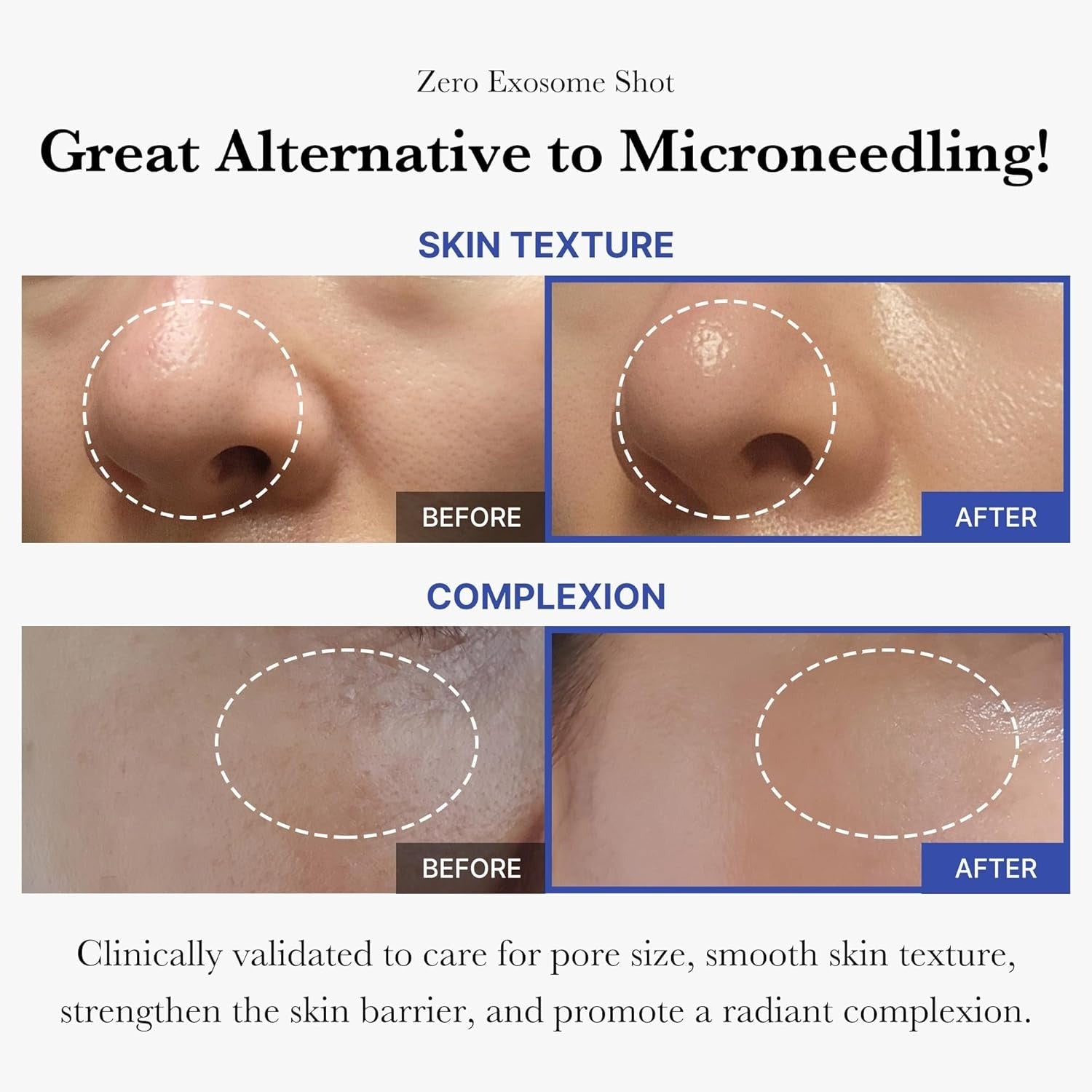 Medicube One Day Exosome Shot Pore Ampoule - 30 ml.