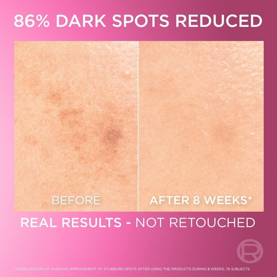 L’Oréal Paris Glycolic Bright Serum 30Ml.